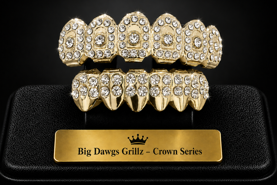 14K Gold Plated Upper & Lower Grillz Set Crown Series