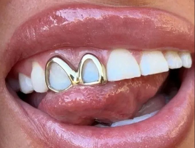 14K Gold Plated Iced Double Open Face Grillz Set