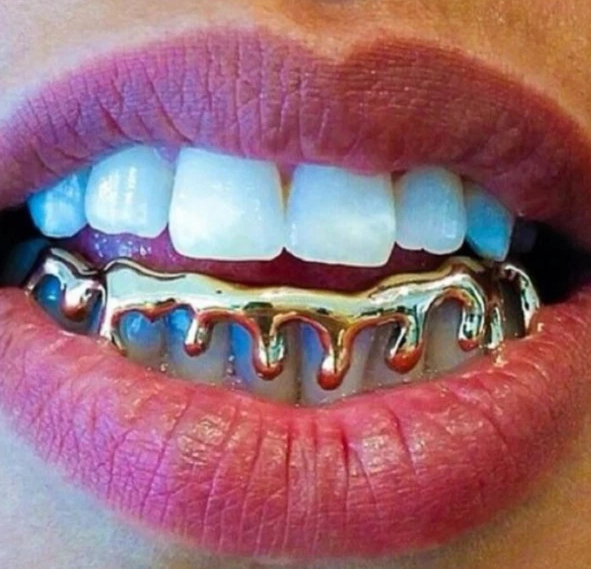 14K Gold Plated Drip Lower Teeth Grillz Set