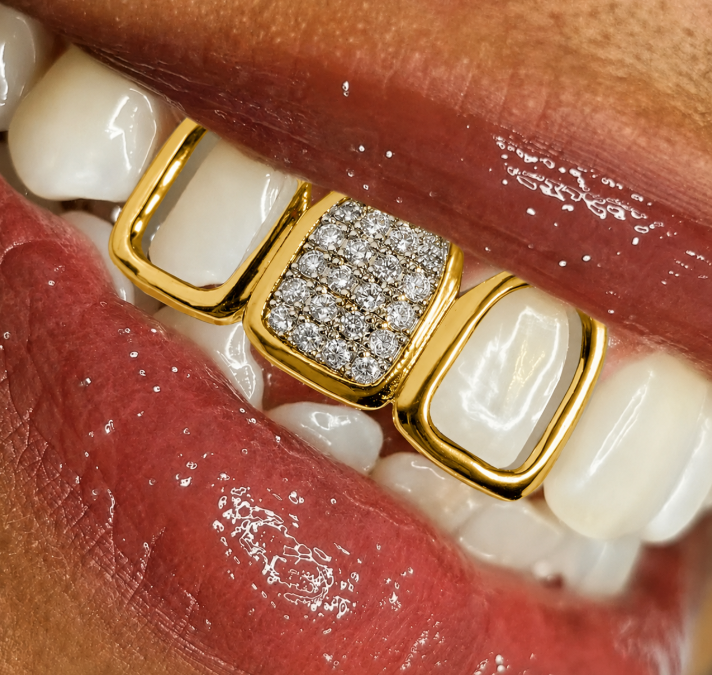 14K Gold Plated Iced 3 Tooth Open Face Iced CZ Grillz Set