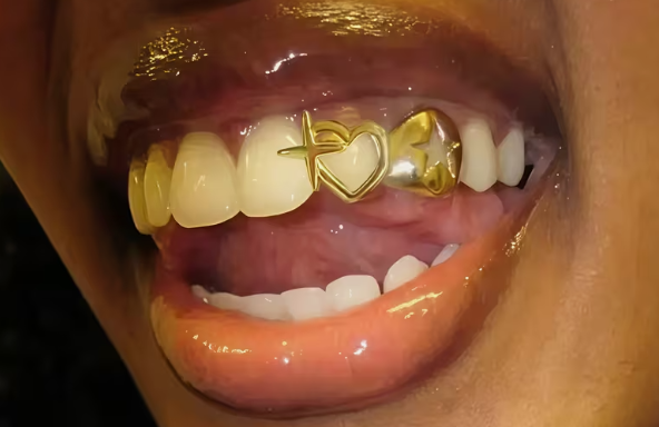 Custom Fit 14K Gold Plated Open Face Heart + Star Teeth Grillz Cap