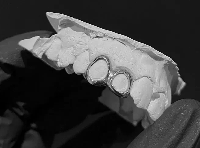 Silver Plated Open Face Double Cap Grillz