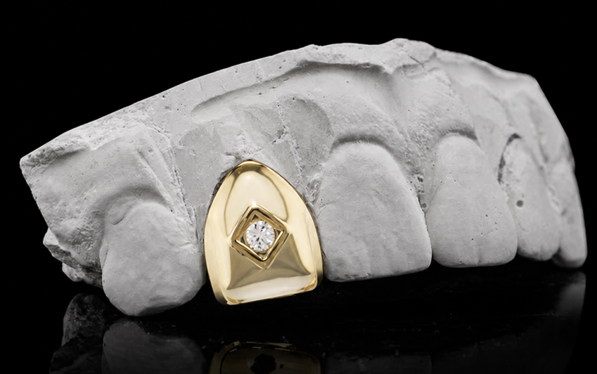 14K Gold Plated Single Centered Diamond Tooth Grillz Cap