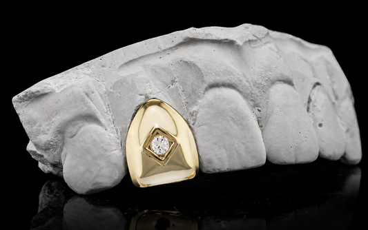 14K Gold Plated Single Centered Diamond Tooth Grillz Cap