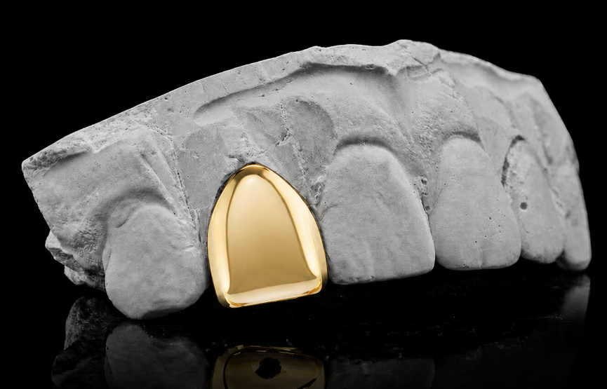 14K Gold Plated Single Tooth Grillz Cap