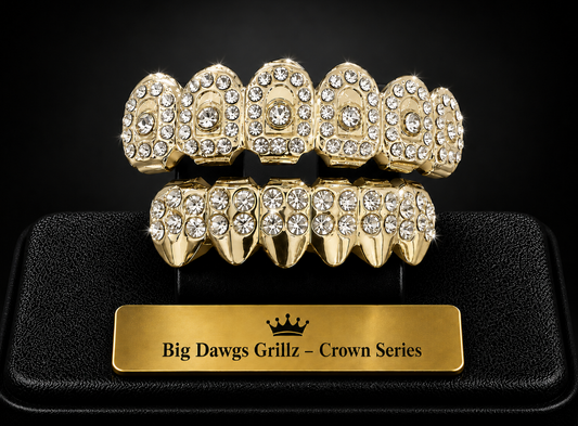 14K Gold Plated Upper & Lower Grillz Set Crown Series