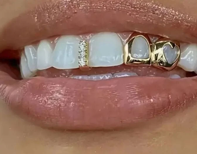 14K Gold Plated Iced CZ Gap + Double Open Face Heart Grillz Set