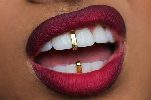 14K Gold Plated Gap Fill Grillz 2pc Set