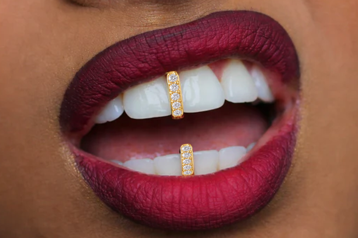14K Gold Plated Iced Gap Fill Grillz 2pc Set