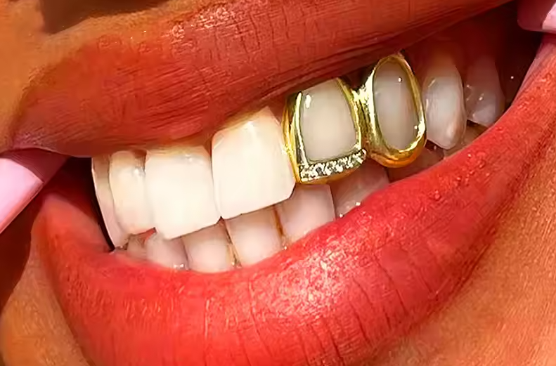 14K Gold Plated Iced Double Open Left Side Grillz Cap