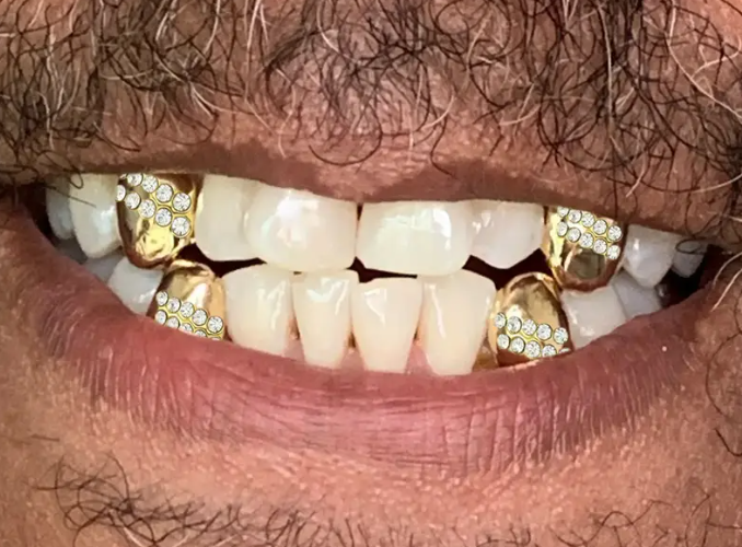 14K Gold Plated Iced Grillz Cap 4pc Set