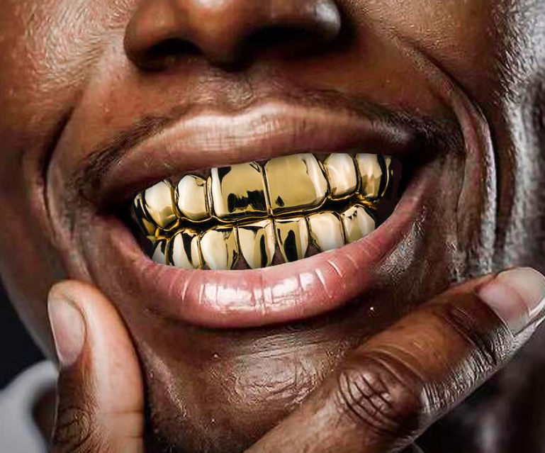 14K Gold Plated 8 Upper & 8 Lower Grillz Set
