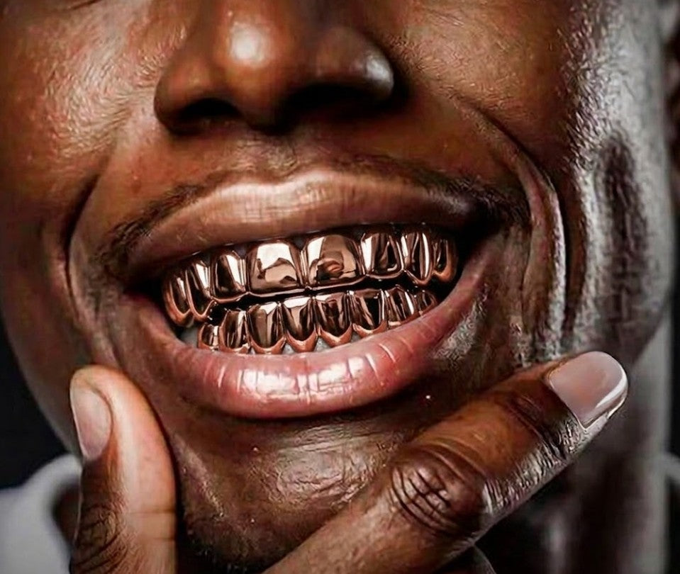 14K Rose Gold Plated 8 Upper & 8 Lower Grillz Set