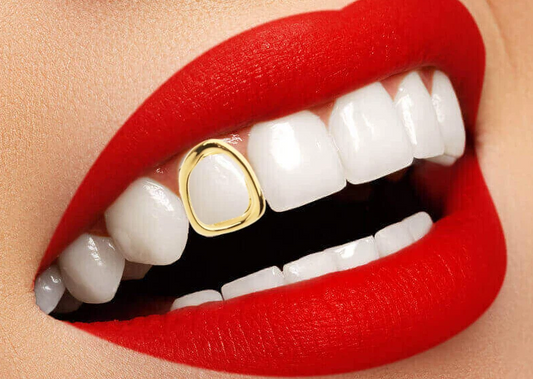 14K Gold Plated Open Face Cap Grillz