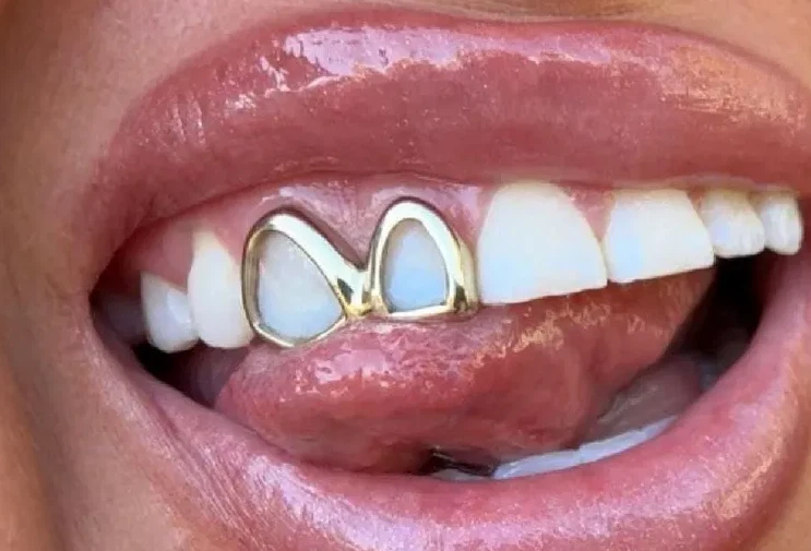 14K Gold Plated Open Face Double Cap Grillz
