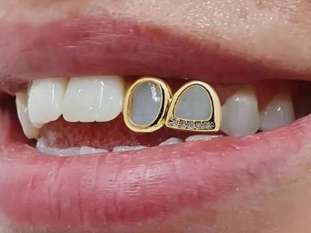 14K Gold Plated Iced Double Open Left Side Grillz Cap