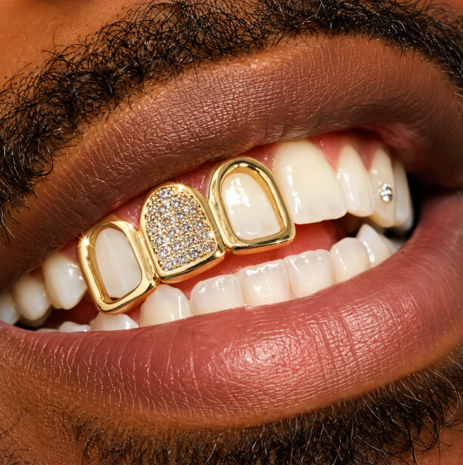 14K Gold Plated Iced 3 Tooth Open Face Iced CZ Grillz Set