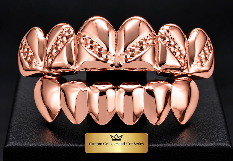 14K Rose Gold Plated Upper & Lower Grillz Set Diamond Cut Series 01