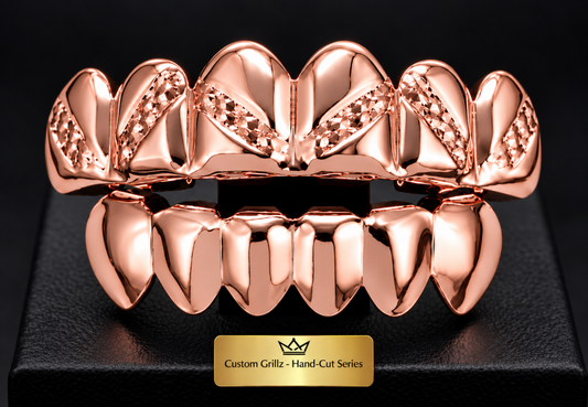 14K Rose Gold Plated Upper & Lower Grillz Set Diamond Cut Series 01