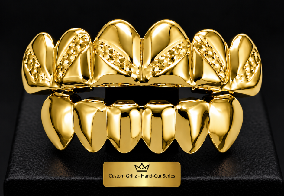 14K Gold Plated Upper & Lower Grillz Set Diamond Cut Series 01